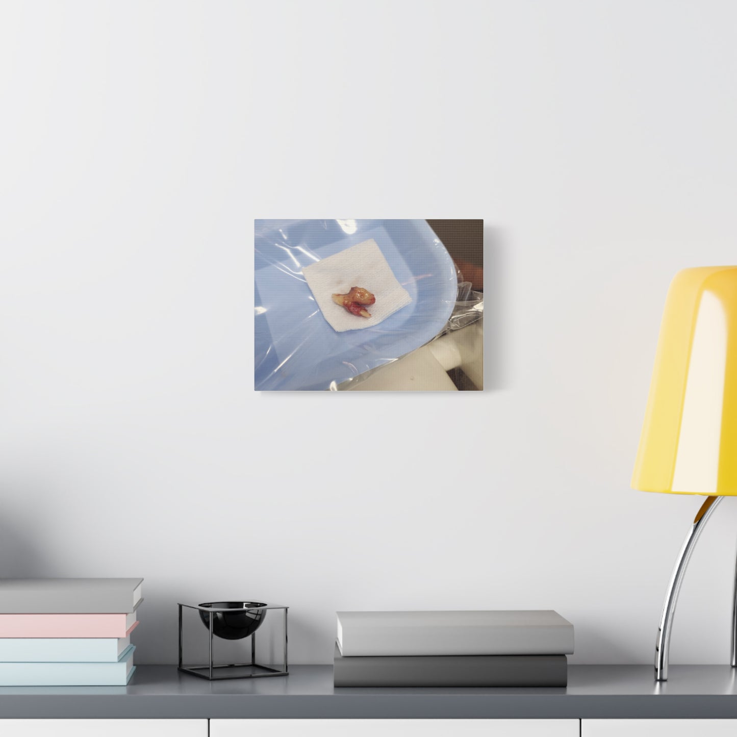 Unique Stretched Matte Canvas Art - Dental Curiosities Decor