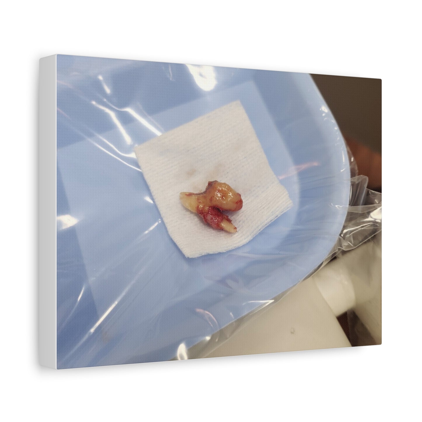 Unique Stretched Matte Canvas Art - Dental Curiosities Decor